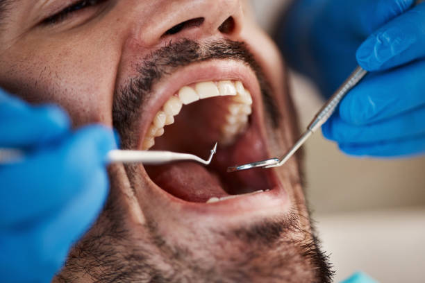 Best Emergency Broken Tooth Repair in Benton Heights, MI