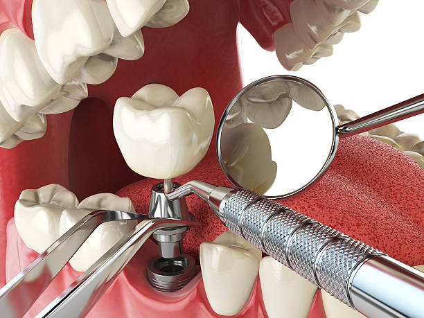 Best 24-Hour Emergency Dentist in Benton Heights, MI